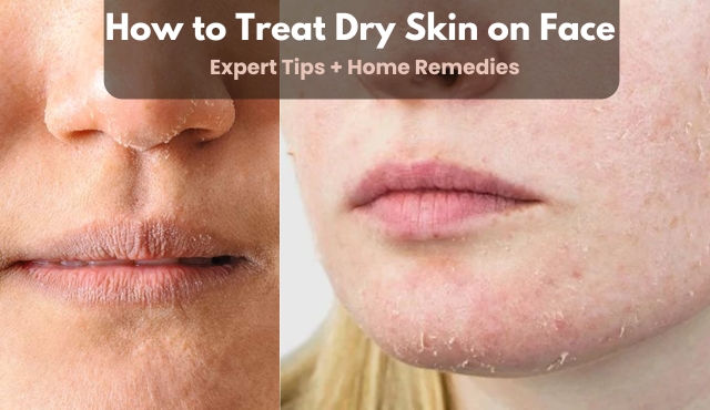 how to treat dry skin on face